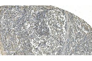 IHC analysis of LSM5 using anti-LSM5 antibody (ABIN7602503).
