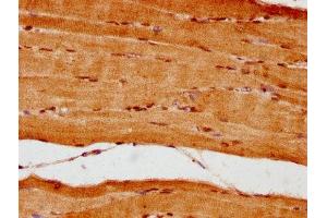 IHC image of ABIN7161836 diluted at 1:300 and staining in paraffin-embedded human skeletal muscle tissue performed on a Leica BondTM system. (NUP62 Antikörper  (AA 173-522))