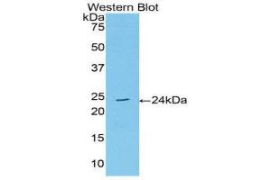 Western Blotting (WB) image for anti-Acetylcholinesterase (AChE) (AA 377-574) antibody (ABIN1174622)