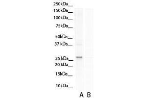 Western Blotting (WB) image for anti-Aspartate beta-Hydroxylase (ASPH) (N-Term) antibody (ABIN2784532)
