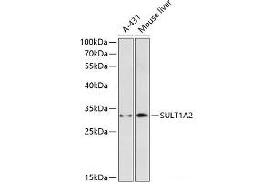 Western blot analysis of extracts of various cell lines using SULT1A2 Polyclonal Antibody at dilution of 1:3000. (SULT1A2 Antikörper)