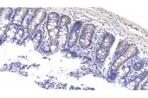 Detection of MT1 in Rat Colon Tissue using Polyclonal Antibody to Metallothionein 1 (MT1)