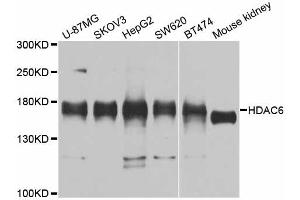 Western blot analysis of extracts of various cell lines, using HDAC6 antibody. (HDAC6 Antikörper)