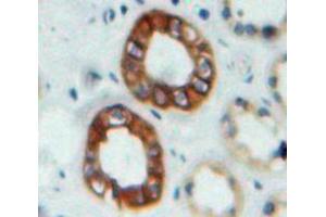 Used in DAB staining on fromalin fixed paraffin-embedded Kidney tissue (Nephrin Antikörper  (AA 27-234))