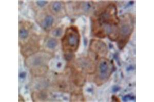 Used in DAB staining on fromalin fixed paraffin-embedded Liver tissue (APOB Antikörper  (AA 3365-3548))