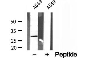 Western blot analysis of extracts of A549 cells, using RAB3D antibody. (RAB3D Antikörper  (Internal Region))