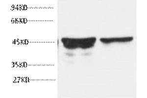 Western blot analysis of rat brain tissue, diluted at 1:5000.