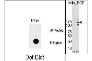 (LEFT)Dot blot analysis of Phospho-EGFR- polyclonal antibody (ABIN1881283 and ABIN2839662) on nitrocellulose membrane. (EGFR Antikörper  (pTyr1069))