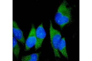 IF analysis of Claudin18/CLDN18 using anti-Claudin18/CLDN18 antibody (ABIN7601257). (Claudin 18 Antikörper  (AA 31-261))