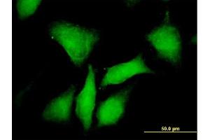 Immunofluorescence (IF) image for anti-Protein Kinase, CAMP-Dependent, Regulatory, Type I, beta (PRKAR1B) (AA 1-381) antibody (ABIN519183)