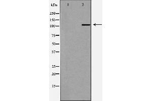 Western blot analysis of Hela whole cell lysates, using MTR4 Antibody. (MTR4 Antikörper  (Internal Region))