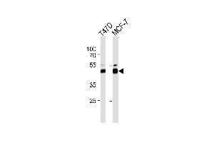 Western blot analysis of lysate from T47D,MCF-7 cell line,using RAD23B Antibody (ABIN486117 and ABIN1535498).