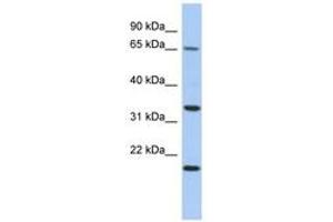 Image no. 1 for anti-Tumor Protein P63 Regulated 1 (TPRG1) (AA 35-84) antibody (ABIN6743909) (TPRG1 Antikörper  (AA 35-84))