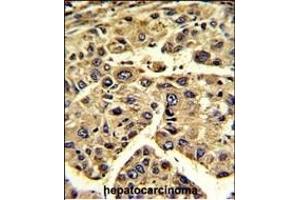 Immunohistochemistry (Paraffin-embedded Sections) (IHC (p)) image for anti-Eukaryotic Translation Initiation Factor 3 Subunit H (EIF3H) (AA 234-263), (C-Term) antibody (ABIN1882076)