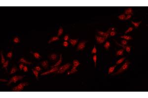 ABIN6269224 staining MCF-7 cells by IF/ICC. (IRS1 Antikörper)