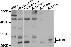 Western blot analysis of extracts of various cell lines, using ALKBH6 antibody (ABIN4902898) at 1:1000 dilution. (ALKBH6 Antikörper)