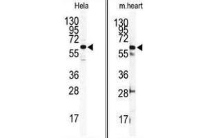 (LEFT) Western blot analysis of anti-ILK2/ILK1 Antibody (C-term) in Hela cell line lysates (35ug/lane). (ILK Antikörper  (C-Term))