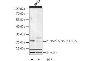 Western blot analysis of extracts of HeLa cells, using Phospho-HSP27/HSPB1-S15 antibody  at 1:1000 dilution. (HSP27 Antikörper  (pSer15))