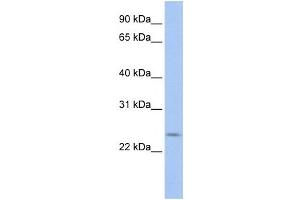 Western Blotting (WB) image for anti-PRELI Domain Containing 2 (PRELID2) antibody (ABIN2459676) (PRELID2 Antikörper)