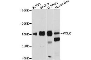 Western blot analysis of extracts of various cell lines, using POLK antibody (ABIN6290755) at 1:1000 dilution.