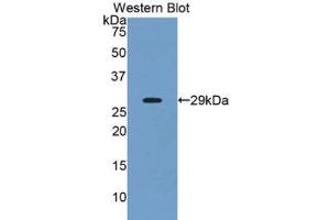 Western Blotting (WB) image for anti-Angiopoietin-Like 2 (ANGPTL2) (AA 267-493) antibody (ABIN1175210) (ANGPTL2 Antikörper  (AA 267-493))