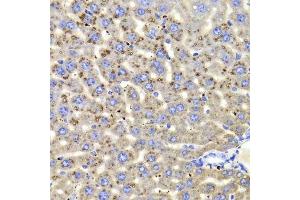 Immunohistochemistry of paraffin-embedded mouse liver using HSD17B13 Antibody. (HSD17B13 Antikörper  (AA 20-300))