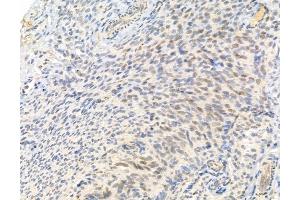 anti-GLI Family Zinc Finger 2 (GLI2) (N-Term) antibody