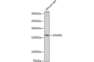 Western blot analysis of extracts of Mouse eye, using CF antibody (ABIN7266399) at 1:1000 dilution. (CFAP61 Antikörper)