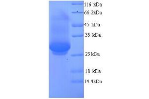 SDS-PAGE (SDS) image for Dynamin 1 (DNM1) (AA 2-245), (partial) protein (His tag) (ABIN5713404) (Dynamin 1 Protein (DNM1) (AA 2-245, partial) (His tag))