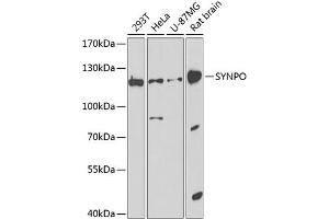 Western blot analysis of extracts of various cell lines, using SYNPO antibody (ABIN6128791, ABIN6148774, ABIN6148776 and ABIN6224561) at 1:1000 dilution. (SYNPO Antikörper  (AA 1-260))