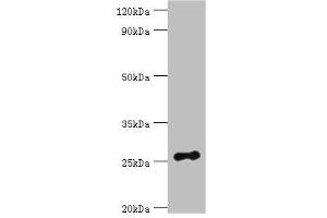 Western blot All lanes: Vesicle-associated membrane protein-associated protein B/C antibody at 3 μg/mL + Mouse brain tissue Secondary Goat polyclonal to rabbit IgG at 1/10000 dilution Predicted band size: 28, 12 kDa Observed band size: 28 kDa (VAPB Antikörper  (AA 10-222))