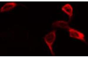 ABIN6268974 staining NIH-3T3 by IF/ICC. (EIF4B Antikörper  (pSer422))