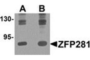 Western blot analysis of ZFP281 in A-20 cell lysate with ZFP281 antibody at (A) 0. (ZNF281 Antikörper  (C-Term))