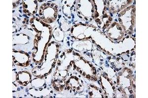 Immunohistochemical staining of paraffin-embedded prostate tissue using anti-SATB1mouse monoclonal antibody. (SATB1 Antikörper)