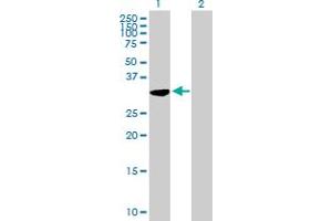 Western Blot analysis of C21orf59 expression in transfected 293T cell line by C21orf59 MaxPab polyclonal antibody. (C21orf59 Antikörper  (AA 1-290))