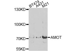 Western blot analysis of extracts of various cell lines, using AMOT antibody (ABIN5975255) at 1/1000 dilution. (Angiomotin Antikörper)