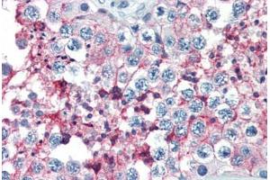 Human Testis (formalin-fixed, paraffin-embedded) stained with BSG antibody ABIN396957 at 10 ug/ml followed by biotinylated anti-mouse IgG secondary antibody ABIN481714, alkaline phosphatase-streptavidin and chromogen. (CD147 Antikörper)