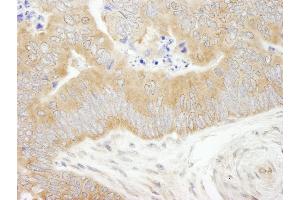 Immunohistochemistry (IHC) image for anti-eIF2 alpha/eif2s1 (C-Term) antibody (ABIN7448959) (eIF2 alpha/eif2s1 (C-Term) Antikörper)