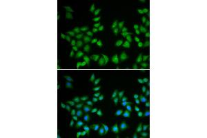 Immunofluorescence analysis of A549 cell using EIF6 antibody. (EIF6 Antikörper)