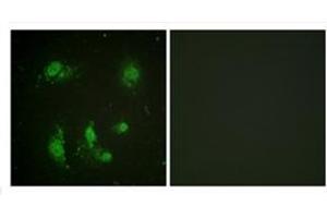Immunofluorescence analysis of HeLa cells, using Survivin Antibody . (Survivin Antikörper)