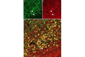 Hm1a toxin co-localizes with Anti-SCN1A (NaV1.