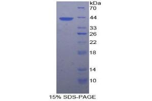SDS-PAGE analysis of Rat Platelet Factor 4 Protein. (PF4 Protein)