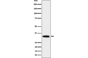 Western blot analysis of PPP6C expression in HeLa cell lysate.