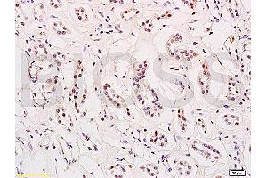 Formalin-fixed and paraffin embedded human kidney tissue labeled with Anti-HES-1 Polyclonal Antibody, Unconjugated (ABIN682393) at 1:200 followed by conjugation to the secondary antibody and DAB staining (HES1 Antikörper  (AA 41-150))