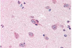 Immunohistochemistry (Paraffin-embedded Sections) (IHC (p)) image for anti-Amyloid beta (A4) Precursor Protein (APP) (AA 18-289) antibody (ABIN364364)