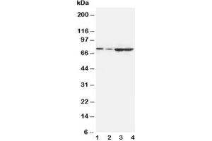 Western blot testing of PCSK9 antibody and Lane 1:  A549;  2: HeLa;  3: U87;  4: PANC cell lysate (PCSK9 Antikörper  (AA 671-687))
