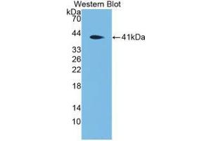 Western blot analysis of the recombinant protein. (DEFA4 Antikörper  (AA 20-92))