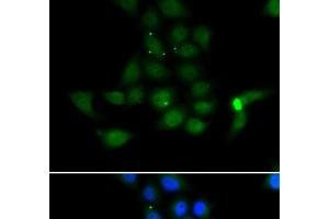 Immunofluorescence analysis of MCF-7 cells using TAT Polyclonal Antibody (Tat Antikörper)