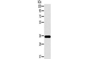 Western Blotting (WB) image for anti-OTU Domain, Ubiquitin Aldehyde Binding 1 (OTUB1) antibody (ABIN2430593) (OTUB1 Antikörper)