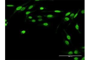 Immunofluorescence of purified MaxPab antibody to TWIST2 on HeLa cell. (TWIST2 Antikörper  (AA 1-160))